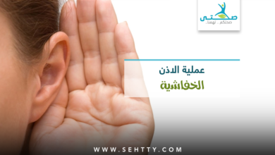 عملية تجميل الاذن الخفاشية