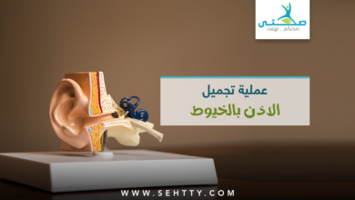 عملية تجميل الاذن بالخيوط