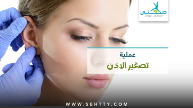عملية تصغير الاذن