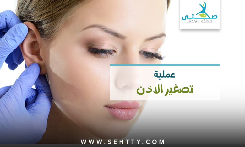 عملية تصغير الاذن