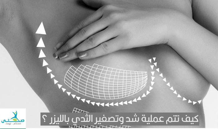 كيفية إجراء عمليات شد وتصغير الثدي بالليزر