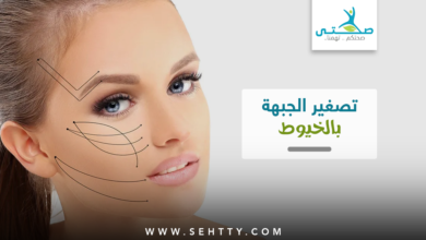 شد و تصغير الجبهة بالخيوط