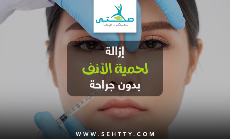 إزالة لحمية الأنف بدون جراحة