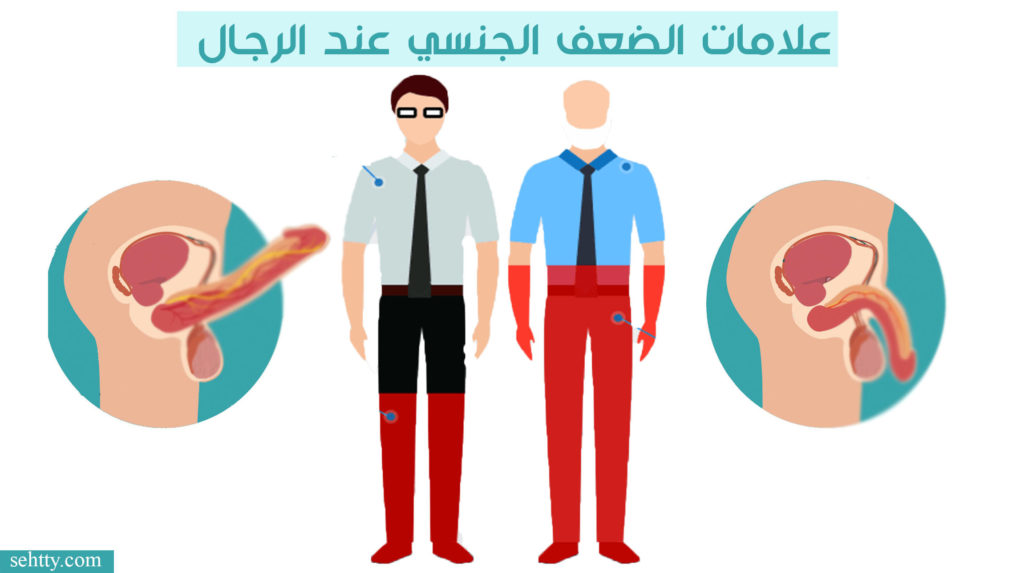 علامات الضعف الجنسي عند الرجال