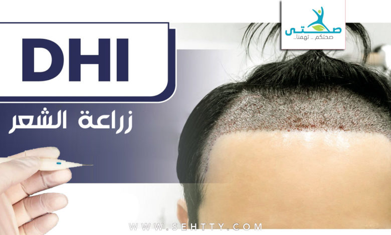 زراعة الشعر بتقنية dhi