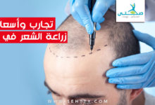 تجارب، وأسعار زراعة الشعر في تركيا