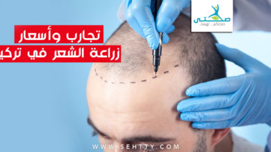 تجارب، وأسعار زراعة الشعر في تركيا