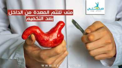 متى تلتئم المعدة من الداخل بعد التكميم