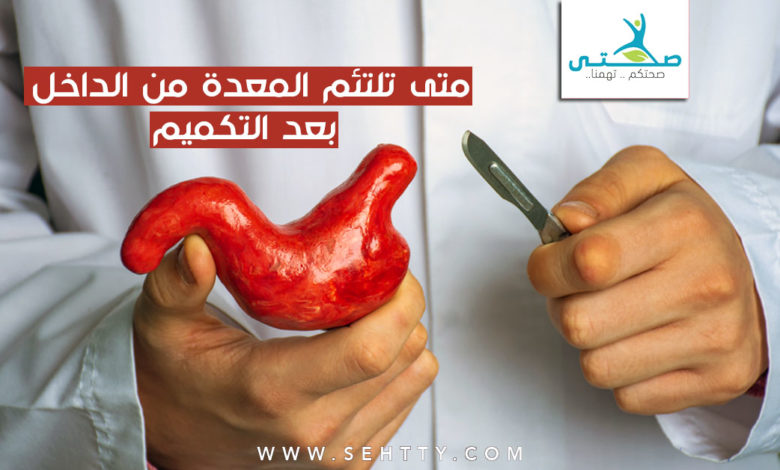 متى تلتئم المعدة من الداخل بعد التكميم